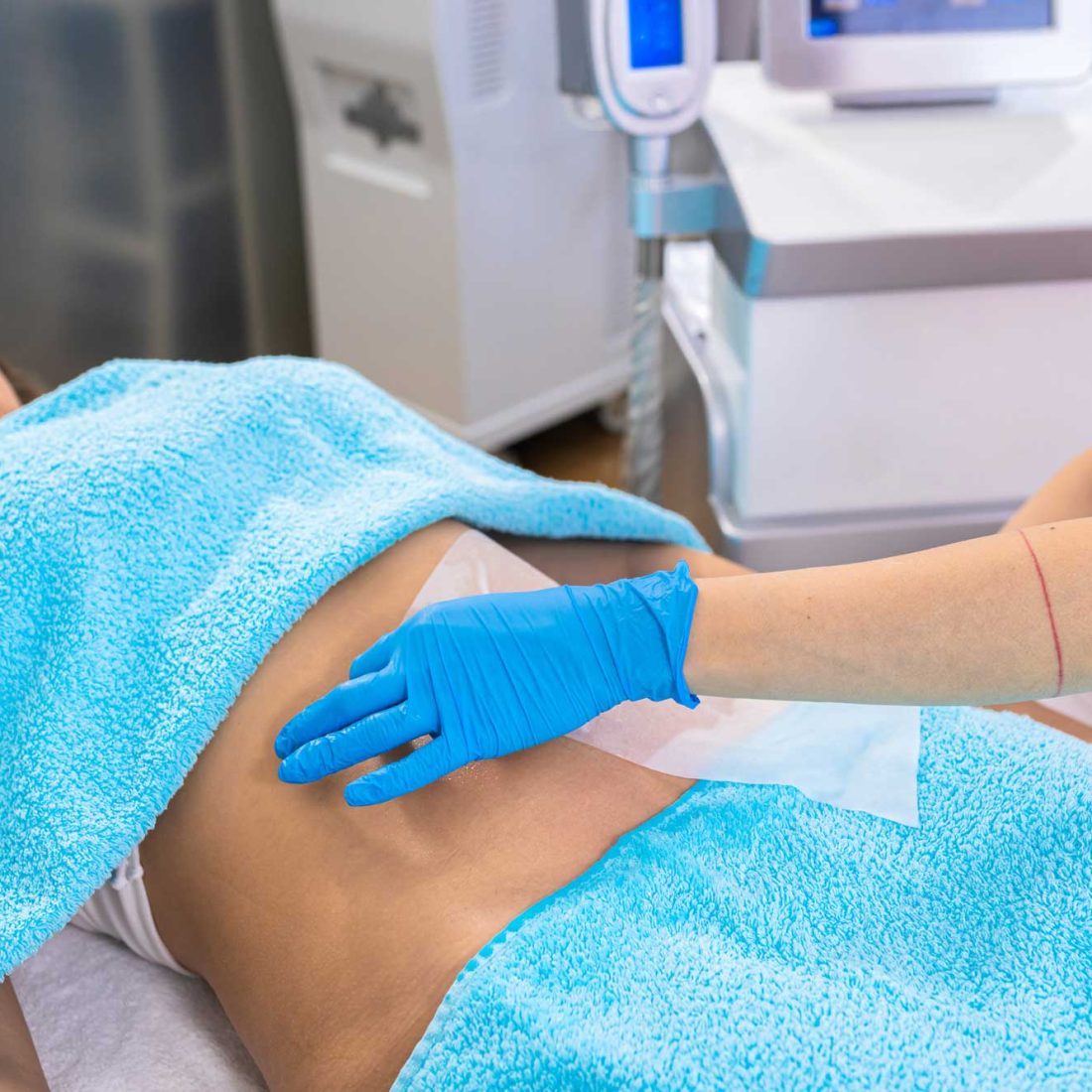 woman-receives-body-treatment-at-modern-clinic-2026-03-18-15-04-43-utc